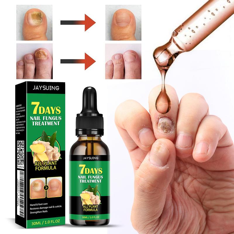 7 Day Ginger Nail Treatment.