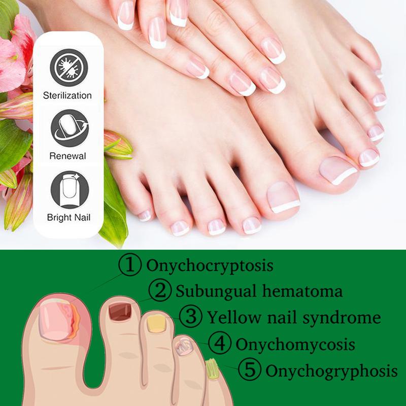 7 Day Ginger Nail Treatment.