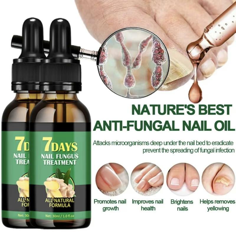 7 Day Ginger Nail Treatment.