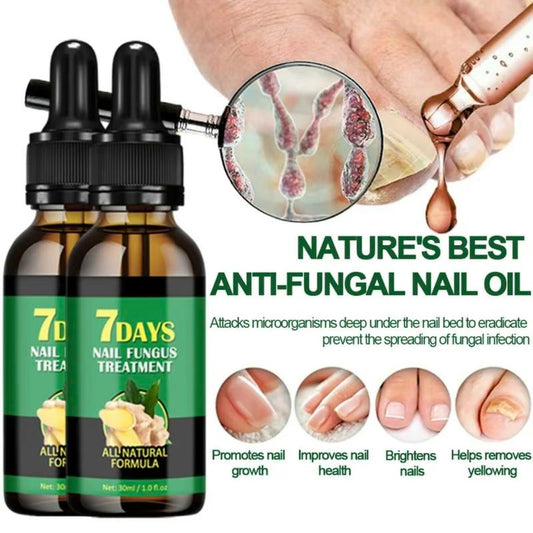 7 Day Ginger Nail Treatment